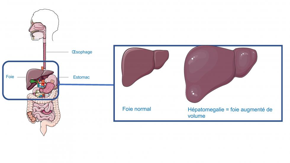 Anatomie du foie (d'après smart, servier)