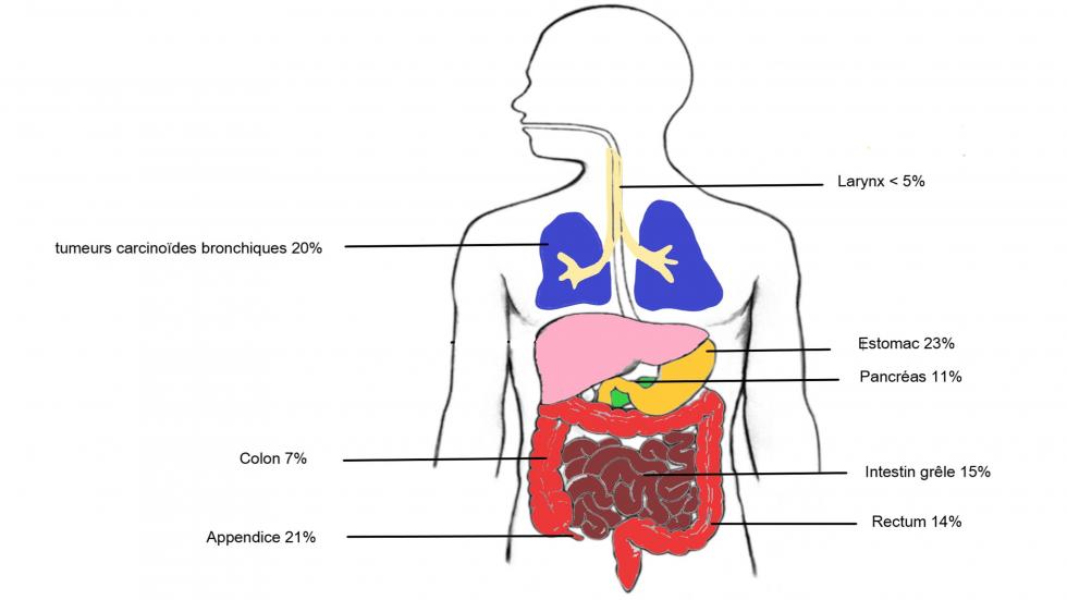 Localisation des tumeurs neuro-endocrines