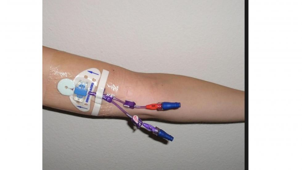 Picc line