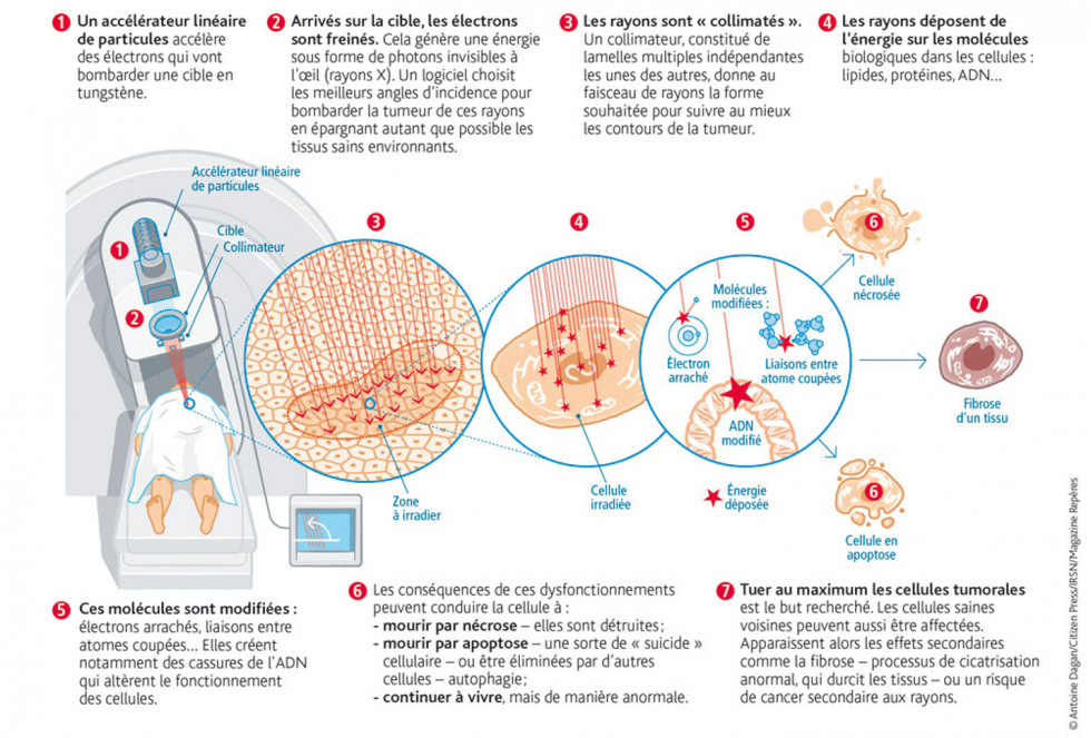 Modalités d'action de la radiothérapie