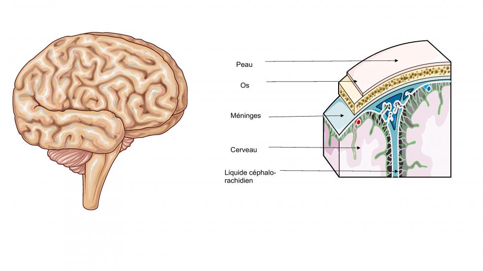 Qu'est ce que le cancer du cerveau ?